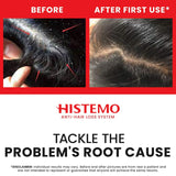 Histemo Anti-Dandruff & Oily Hair Kit, Scalp Cleanser, Shampoo, Conditioner & Hair Tonic, DHT Blocking Hair Restoration Treatment