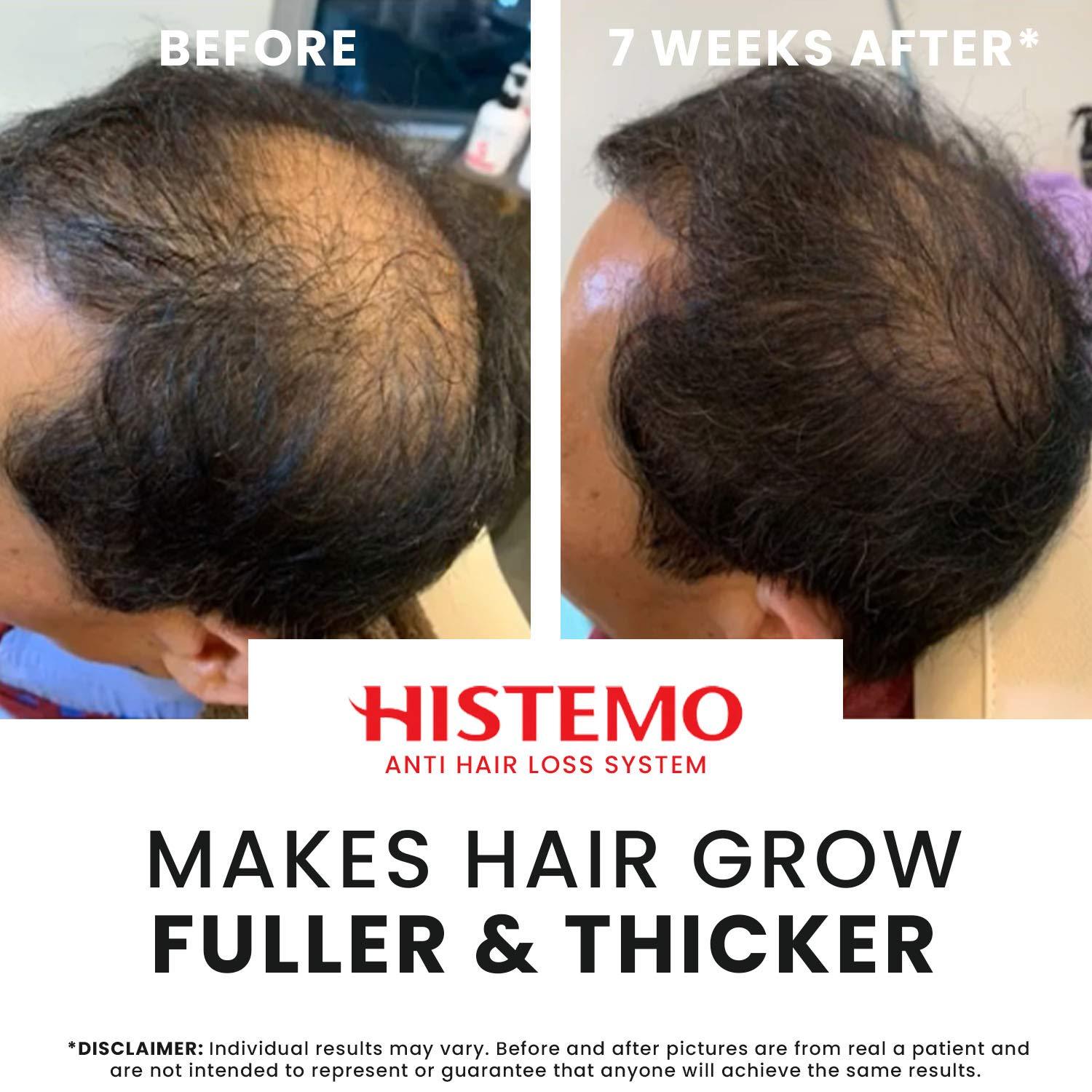 Histemo ION-TO G Hair Tonic Promote Hair Growth