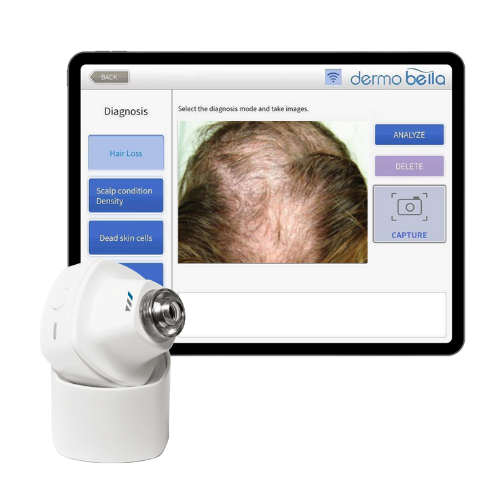 Smart Hair Diagnosis Solution